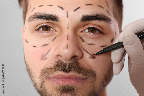 Doctor drawing marks on man's face for cosmetic surgery operation against grey background, closeup photo