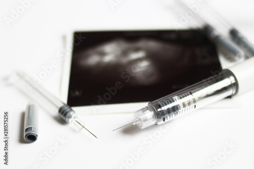 Assisted reproductive technology injection pen and small syringes with ovarian ultrasound in the middle. IVF and IUI Treatment Drugs. Medication  for infertility treatment