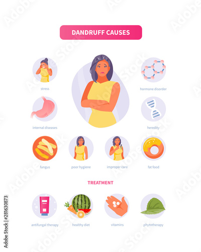 Dandruff Causes and Treatment