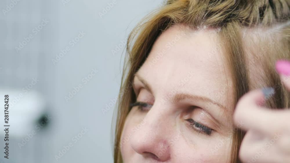 Closeup of the head of an adult European woman with problem skin