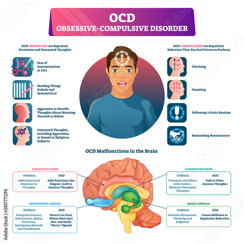 OCD obsessive compulsive disorder labeled explanation vector illustration. photo