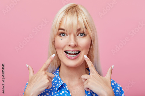 Cheerful happy young woman with blonde hair gesturing thumb up while pointing finger at braces on her teeth isolated over pink background. The concept of a healthy snow-white smile. Daily dental care