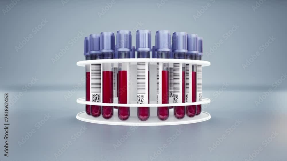 White holder with vacutainers filled with blood samples. Camera zoom to set. 60 fps animation. White holder with vacutainers filled with blood samples. Camera zoom to set. 60 fps animation.
