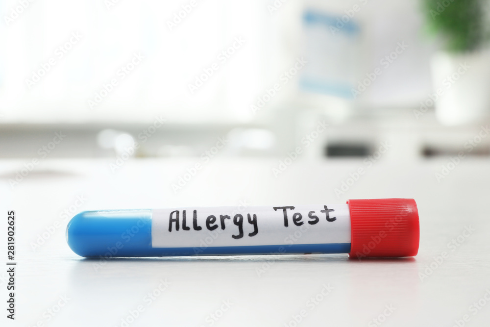 Fototapeta premium Tube with label ALLERGY TEST on white table