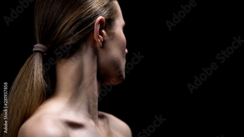 Wallpaper Mural Lady turned face from camera, bullying problem, suffering insecurity and phobias Torontodigital.ca