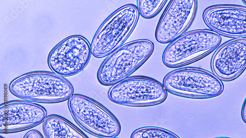 Εκτύπωση καμβά Microscopic image of the eggs of a pinworm (enterobias vermicularis), a parasite common in small school children and associated with an itchy anus