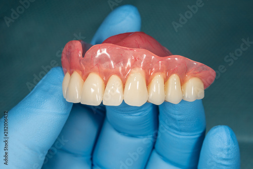 Close-up human denture of the upper jaw on a blue background in the hand of a dentist wearing a medical glove photo