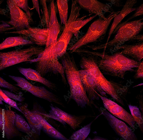 Fibroblast cells mebrane labeled with fluorescent dye