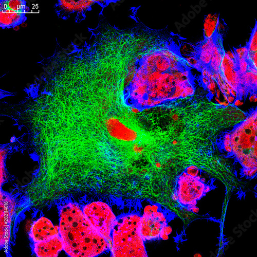 Real fluorescence microscopic view of mice neuroblastoma cell line photo