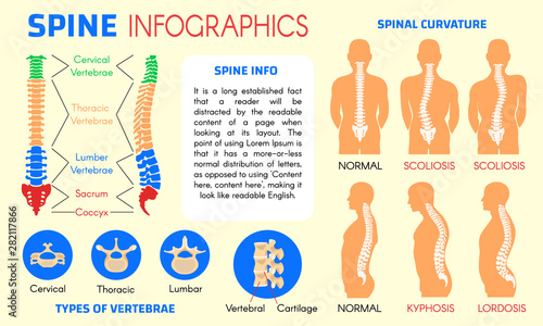 Human spine infographic. Flat illustration of human spine vector infographic for web design