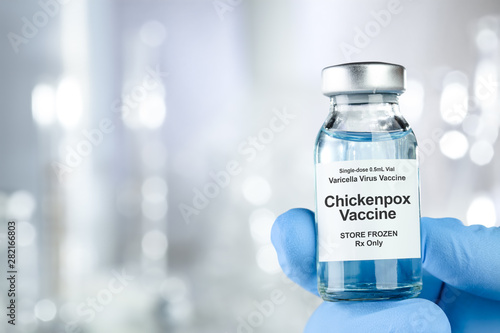 Healthcare concept with a hand in blue medical gloves holding Chicken pox, varicella-zoster virus, vaccine vial