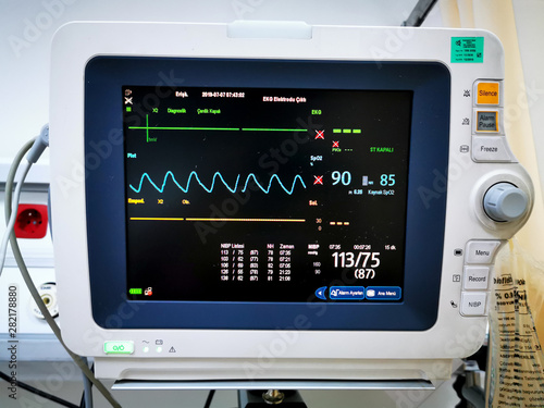 er heartbeat cardio monitor