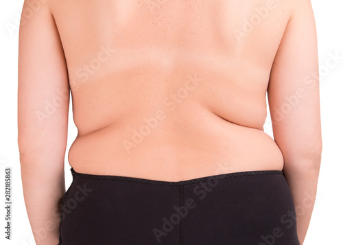 Lateral fat on the girl   s body. Overweight problem. Girl body with fat side isolate on a white background.