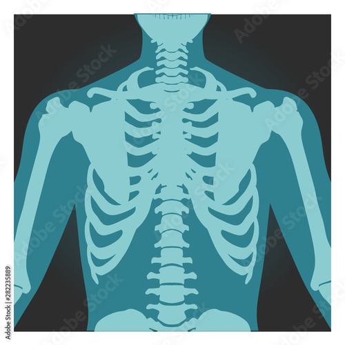 X-ray shot of shoulder, human body bones, radiography, rib cage, chest and arm, vector illustration.