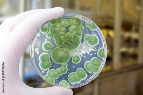 Cuadro en lienzo Colonies of different mold fungi grown from indoor air