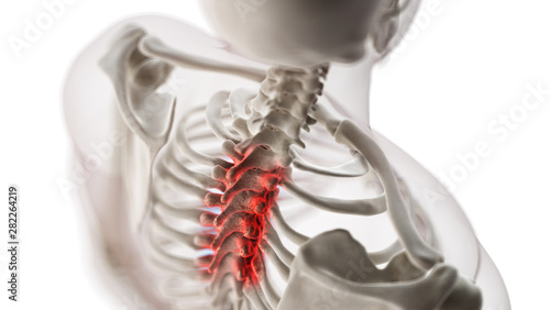 3d rendered medically accurate illustration of an arthritic thoracic spine photo