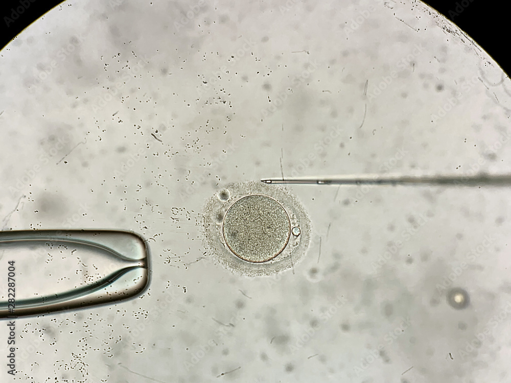 View through microscope at in vitro fertilization process Stock Photo ...