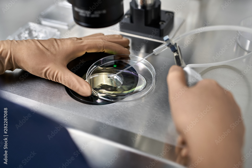 Process of in vitro fertilization in laboratory Process of in vitro fertilization in laboratory