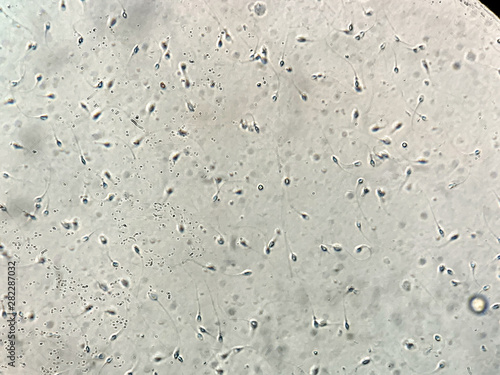 View at human sperm under microscope in lab photo