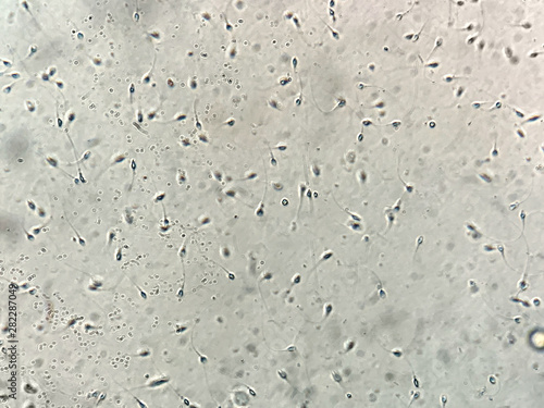 View at human sperm under microscope in lab