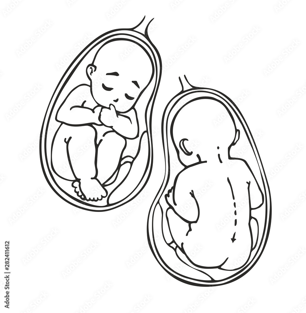 Fetus vector icon, prenatal human child with placenta silhouette isolated on white background. Picture of baby and placenta inside the womb.Simple element illustration. Pregnancy symbol design. Fetus vector icon, prenatal human child with placenta silhouette isolated on white background. Picture of baby and placenta inside the womb.Simple element illustration. Pregnancy symbol design.