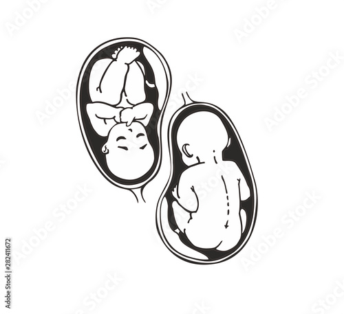 Fetus vector icon, prenatal human child with placenta silhouette isolated on white background. Picture of baby and placenta inside the womb.Simple element illustration. Pregnancy symbol design.