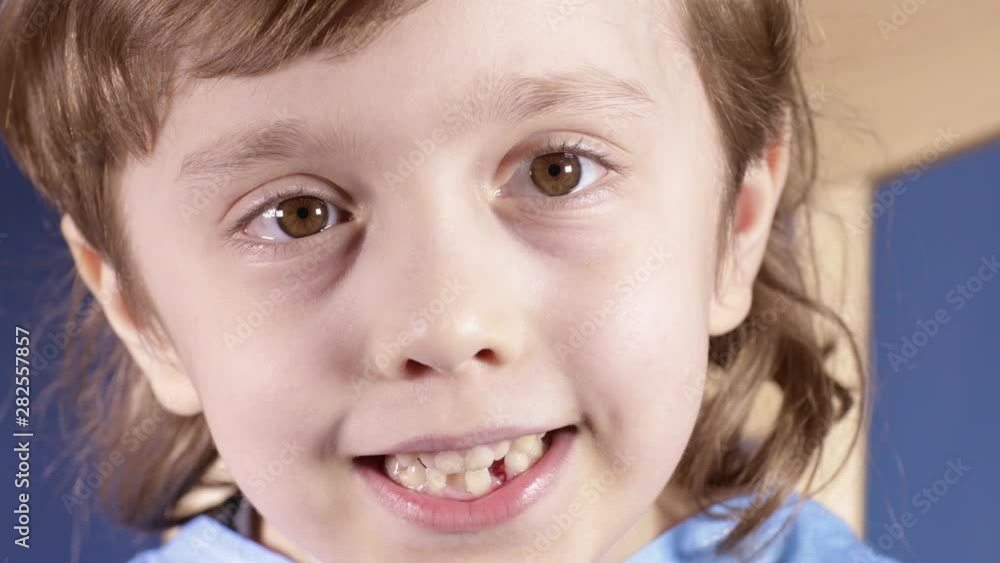 Smiling boy of six years old with bumpy teeth. Closeup Smiling boy of six years old with bumpy teeth. Closeup