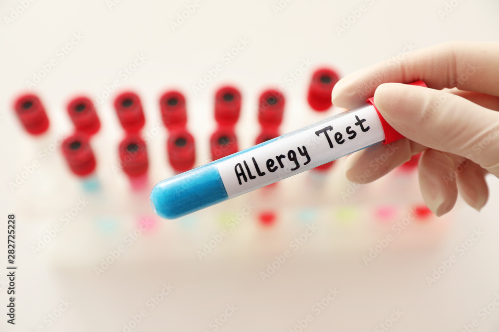Fototapeta premium Doctor holding tube with label ALLERGY TEST over table, closeup