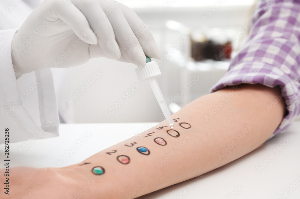 Patient undergoing skin allergy test at light table, closeup Patient undergoing skin allergy test at light table, closeup