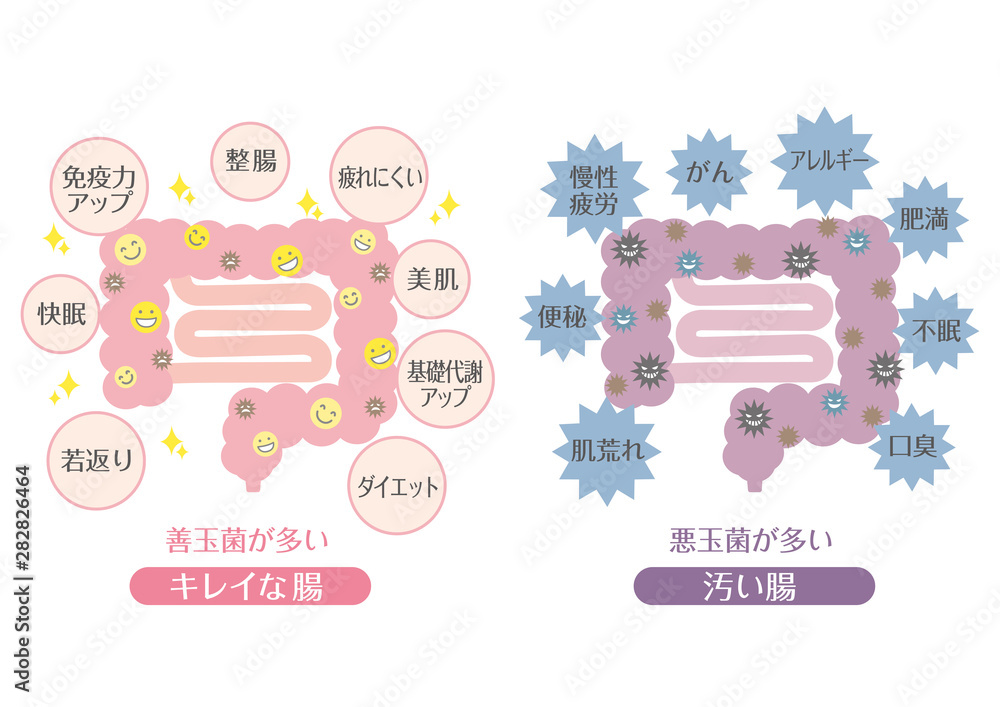 Φωτογραφία 腸内環境のイメージイラスト（良い状態と悪い状態）
