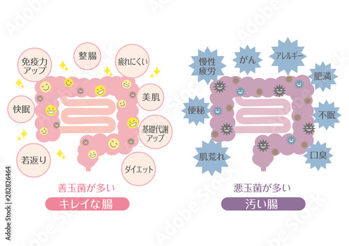 腸活（キレイな腸と汚い腸）