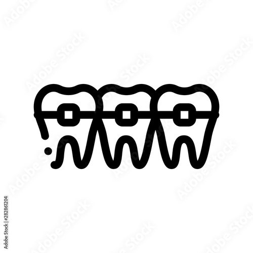 Dentist Stomatology Teeth Braces Vector Sign Icon Thin Line. Teeth Braces Bracket, Orthodontic Appliance Linear Pictogram. Chairside Assistance Dental Health Service Monochrome Contour Illustration