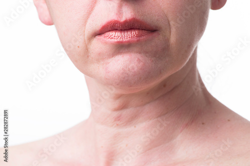 Furrowed lips of a mature woman.Signs of aging skin after 40