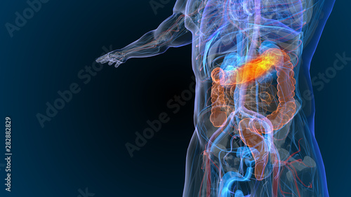 3d rendered illustration of  bowel cancer 3D illustration photo