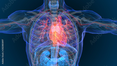 Slika na platnu 3d rendered illustration of  heart attack and heart disease 3D illustration