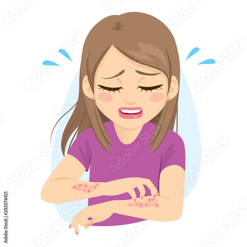 Young woman scratching arms suffering strong allergy skin itchy symptom