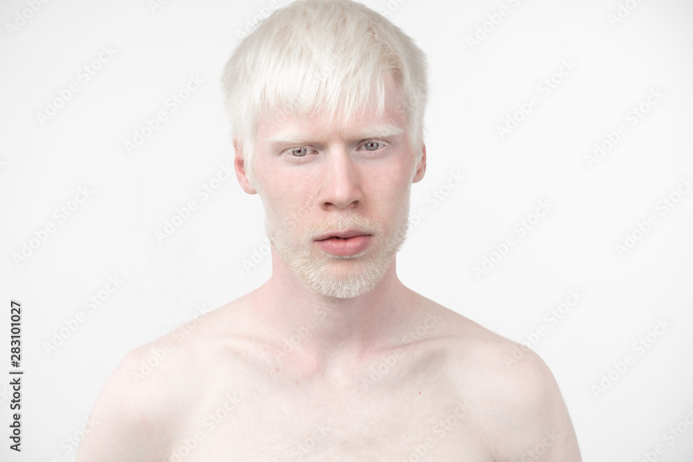 portrait of an albino man in studio dressed t-shirt isolated on a white background. abnormal deviations. unusual appearance portrait of an albino man in studio dressed t-shirt isolated on a white background. abnormal deviations. unusual appearance