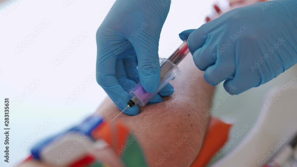 Close-up view of a needle on man's arm to collect blood into syringe. Medical worker in gloves taking blood sample from vein. Close-up view of a needle on man's arm to collect blood into syringe. Medical worker in gloves taking blood sample from vein.