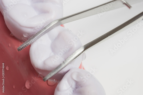 tooth extraction with dentist pint on White background
