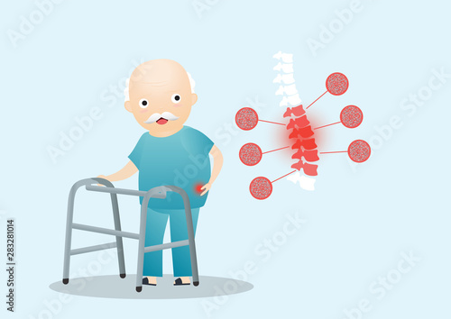 Old Man Osteoporosis Concept.