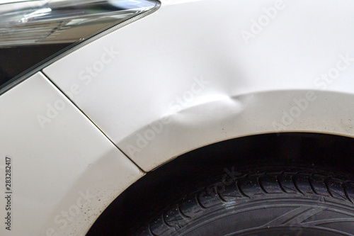 Canvas Print Car dents caused by accidents