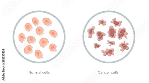 cell structure: normal and cancer