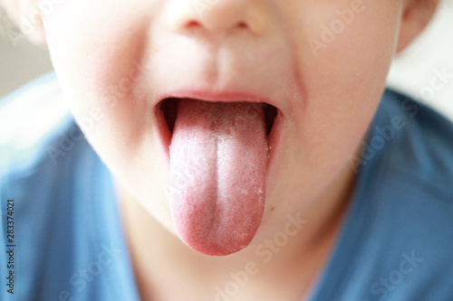 Obraz na plátně Little boy showing his tongue. Child puts out tongue - close up.
