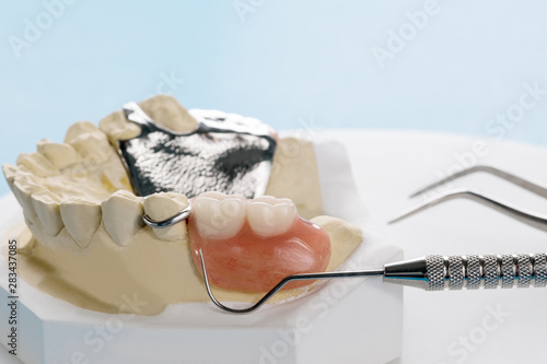 Close up, Removable partial denture (RPD.) on blue background. photo