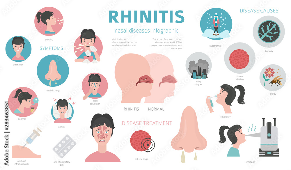 Nasal diseases. Rhinitis symptoms, treatment icon set. Medical