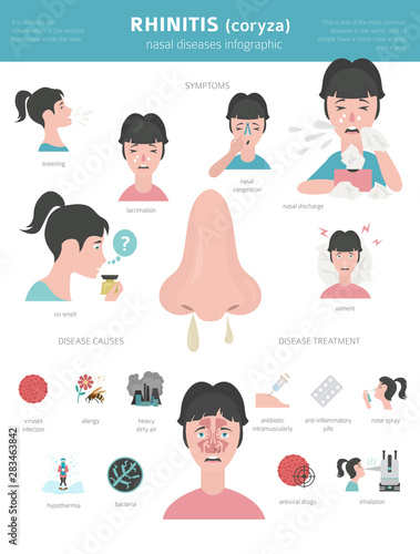 Nasal diseases. Rhinitis symptoms, treatment icon set. Medical infographic design