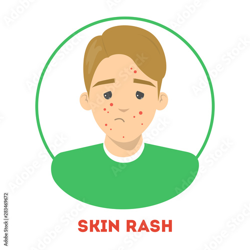 Sad man with a skin rash, dermatology disease. Person