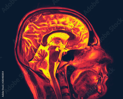 Magnetic resonance imaging of the brain. MRI scan vector