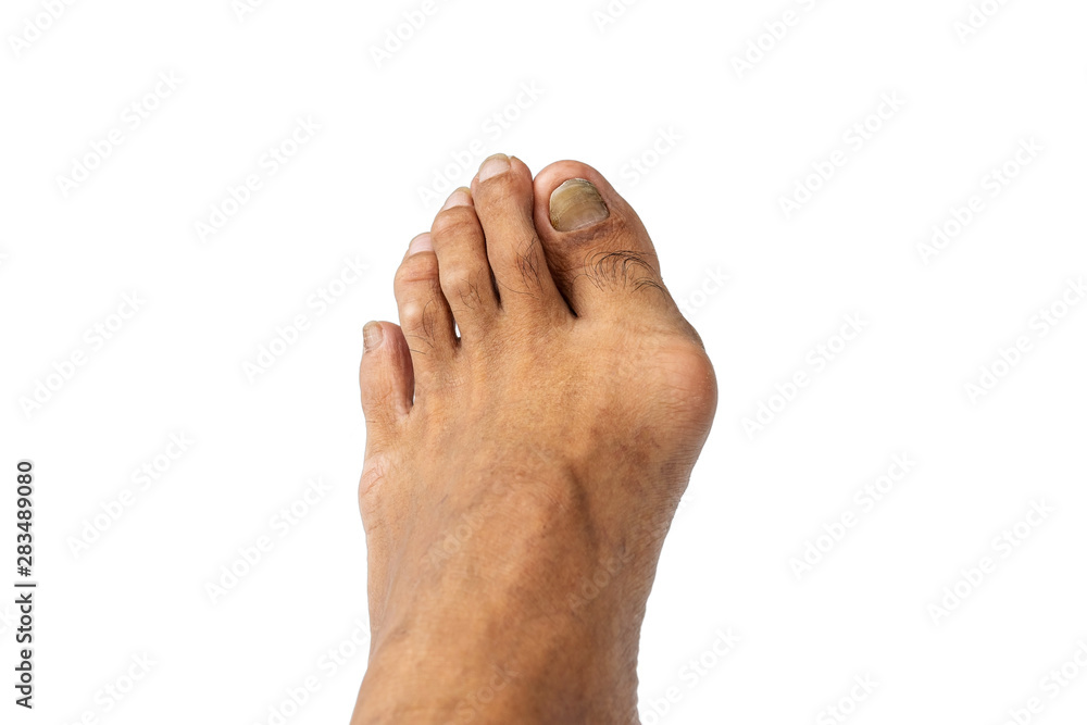 Closeup men's feet isolated on white background. Closeup men's feet isolated on white background.