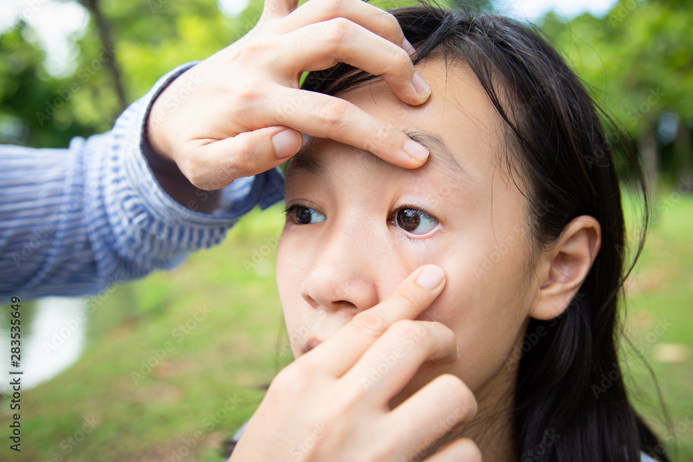 Closeup of hands mother checking child girl patient sore eyes,daughter feel eyes pain,woman